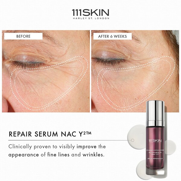  111skin Repair Serum Nac Y2 15ml 