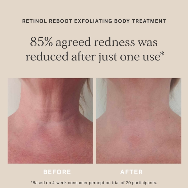  Alpha-h Retinol Reboot Exfoliating Body Treatment With 8% Glycolic Acid 2% Lactic Acid + 1% Encapsuladed Retinol 
