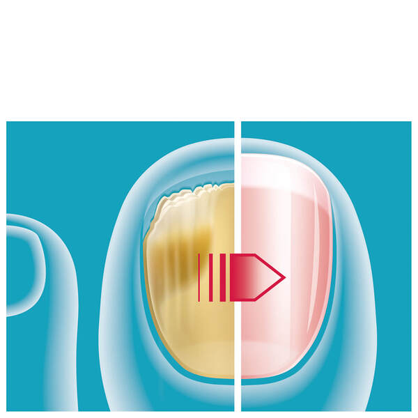  Mavala Mavamed Fungal Nail Solution 5ml 