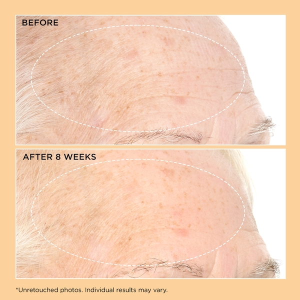  Perricone Md Neuropeptide Pro-strength Firming Moisturiser 