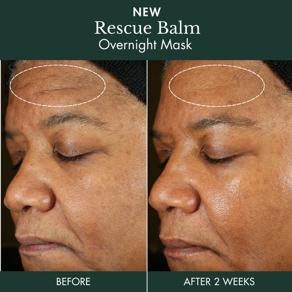  Révive Rescue Balm Overnight Mask 75ml 
