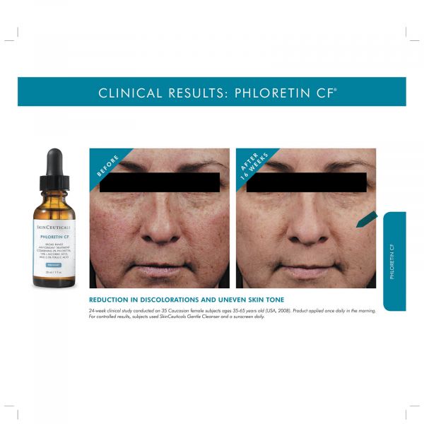  Skinceuticals Phloretin Cf Antioxidant Serum For Normal, Combination, Discolouration-prone Skin Types 